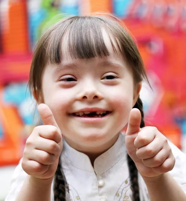 sindrome-de-down1